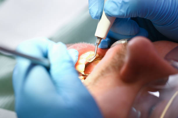 Best Emergency Denture Repair in Payson, UT