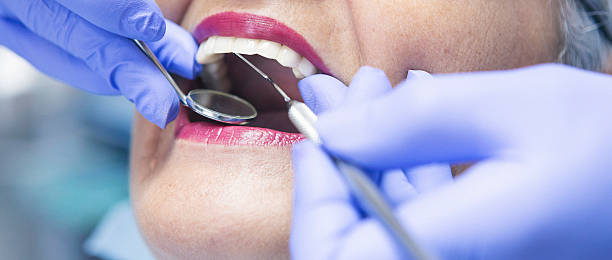 Best Broken or Chipped Tooth Repair in Payson, UT